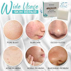 Skin Repair Soap